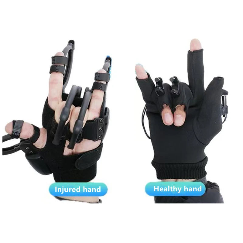 Intelligent Exoskeleton Gloves: Multiple Training Modes for Hand Rehabilitation